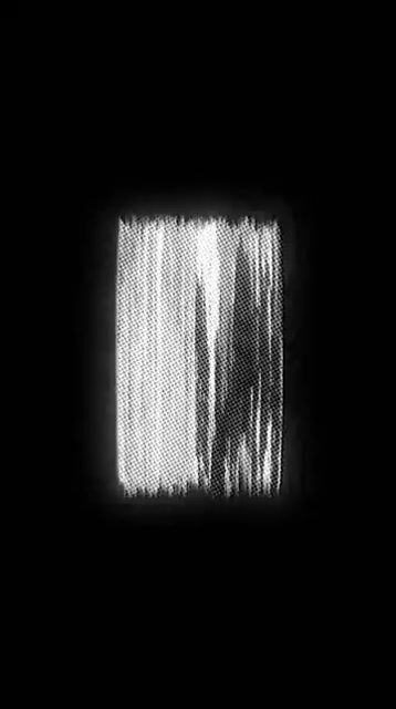 Teeth color|Epidose-3: Bursting the myth