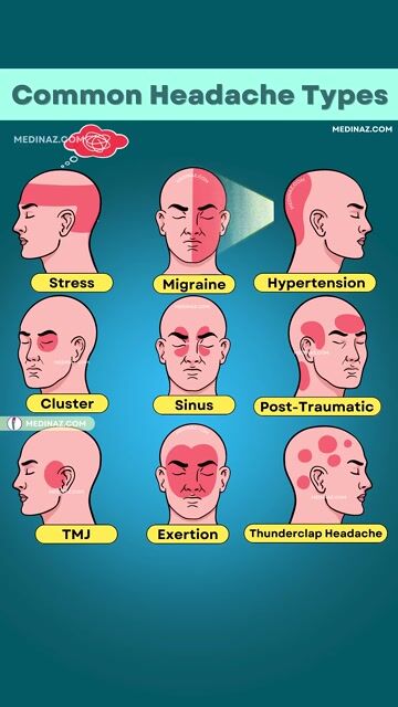 Headaches