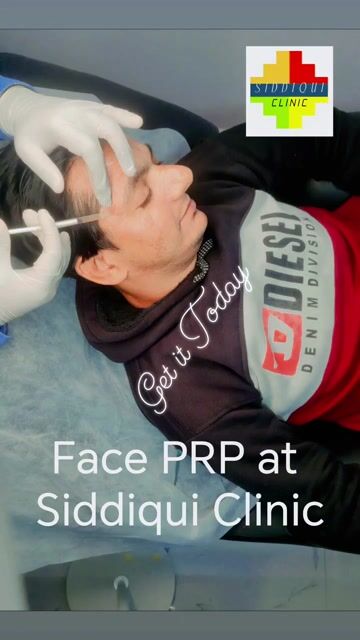 PRP face at SIDDIQUI CLINIC