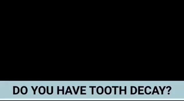 Treatment for dental caries- (பல் சொத்தை), is it necessary?